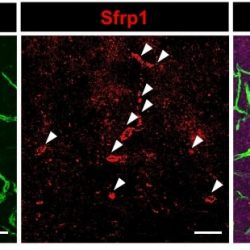 Tumor_blood_vessels_produce the angiocrine_factor, Sfrp1