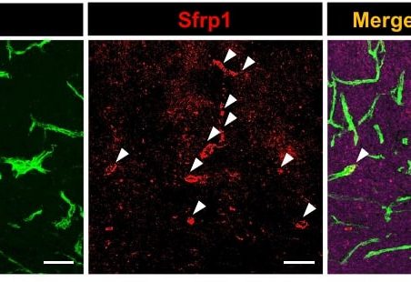 Tumor_blood_vessels_produce the angiocrine_factor, Sfrp1